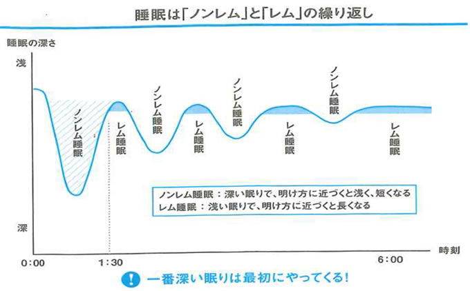 1707SN MMコラム図