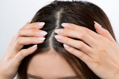 女性の薄毛は分け目を変えない髪型に原因がありますか 育毛の処方箋